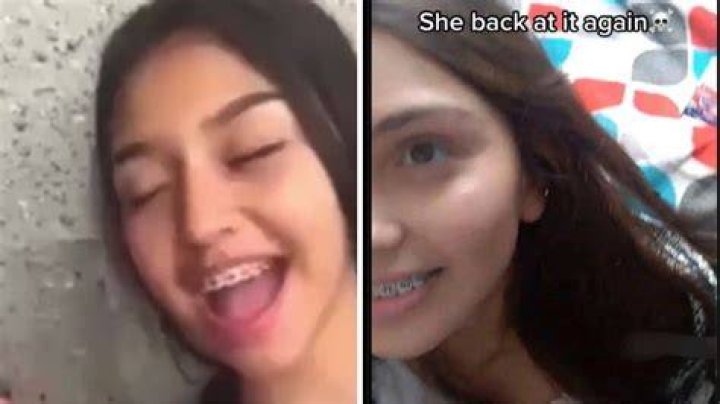Braces Girl Video Viral on TikTok What is it about EducationWeb