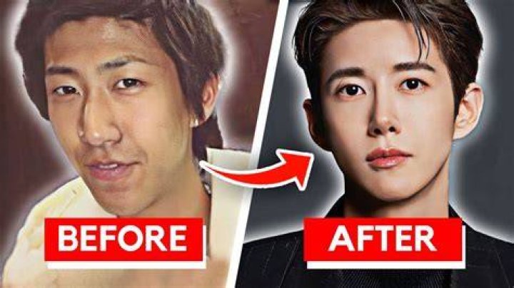 Korean Actors Before And After Plastic Surgery Korean Actors/actresses
